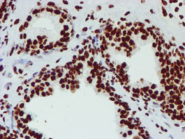 m03515 1 anti nono mouse monoclonal antibody clone id oti4d9 ihc testing 13