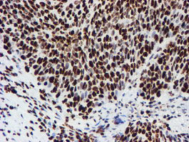 m03515 1 anti nono mouse monoclonal antibody clone id oti4d9 ihc testing 14