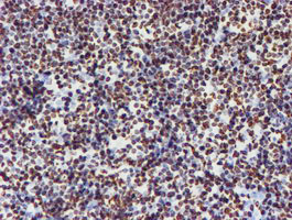 m03515 1 anti nono mouse monoclonal antibody clone id oti4d9 ihc testing 15