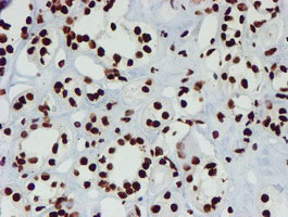m03515 1 anti nono mouse monoclonal antibody clone id oti4d9 ihc testing 16