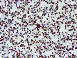 m03515 1 anti nono mouse monoclonal antibody clone id oti4d9 ihc testing 17
