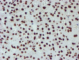 m03515 1 anti nono mouse monoclonal antibody clone id oti4d9 ihc testing 18
