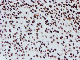 m03515 1 anti nono mouse monoclonal antibody clone id oti4d9 ihc testing 19