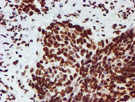 m03515 1 anti nono mouse monoclonal antibody clone id oti4d9 ihc testing 6