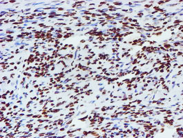 m03515 1 anti nono mouse monoclonal antibody clone id oti4d9 ihc testing 7