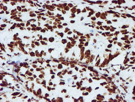 m03515 1 anti nono mouse monoclonal antibody clone id oti4d9 ihc testing 8
