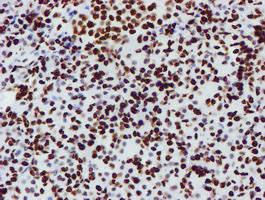 m03515 1 anti nono mouse monoclonal antibody clone id oti4d9 ihc testing 9
