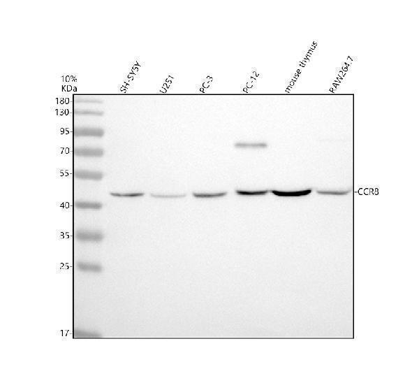 Western blot analysis of CCR8 using anti-CCR8 antibody (M03518)