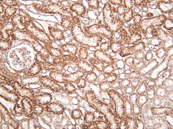 Rat kidney was stained with anti-Bad rabbit antibody