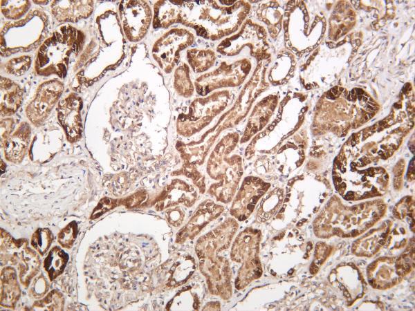 Human kidney was stained with anti-Bad rabbit antibody