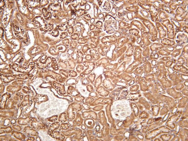Mouse kidney was stained with anti-Bad rabbit antibody