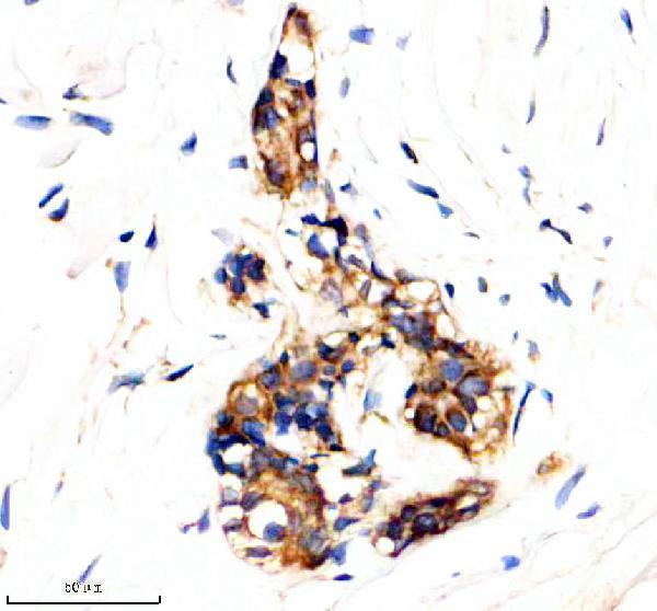 IHC analysis of BAD using anti-BAD antibody (M03520)