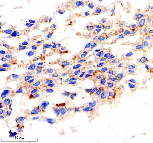 m03520 bad primary antibodies ihc testing 2