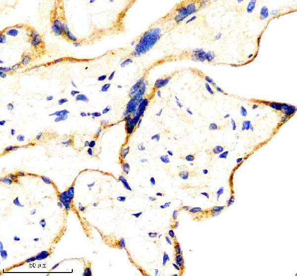 m03520 bad primary antibodies ihc testing 3