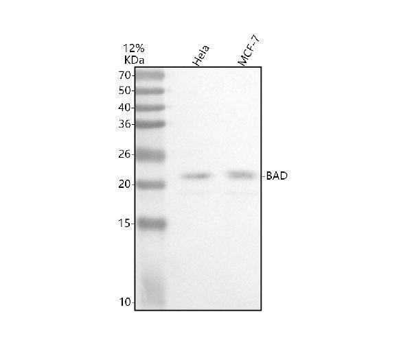  Western blot analysis of BAD using anti-BAD antibody (M03520)