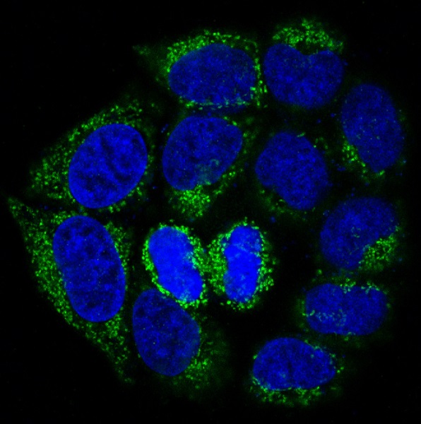 Immunofluorescent analysis of Hela cells, using Bad Antibody 