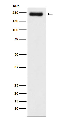 Western blot analysis of Laminin gamma 1 expression in A431 cell lysate