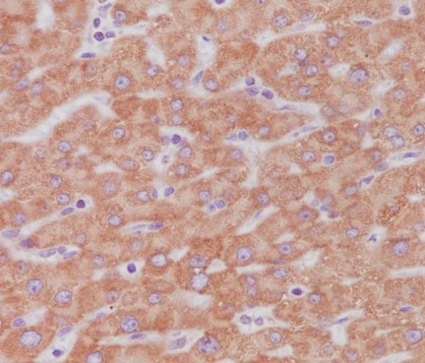 Immunohistochemical analysis of paraffin-embedded human liver, using Cytochrome C Antibody