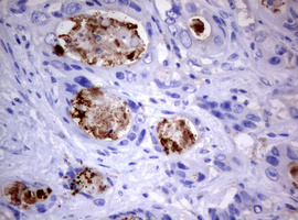m03530 anti pi 3 kinase class 2a pik3c2a mouse monoclonal antibody clone id oti3h2 ihc testing 10