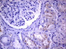 m03530 anti pi 3 kinase class 2a pik3c2a mouse monoclonal antibody clone id oti3h2 ihc testing 11