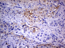 m03530 anti pi 3 kinase class 2a pik3c2a mouse monoclonal antibody clone id oti3h2 ihc testing 3