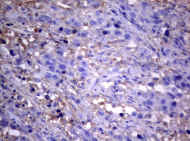 m03530 anti pi 3 kinase class 2a pik3c2a mouse monoclonal antibody clone id oti3h2 ihc testing 4