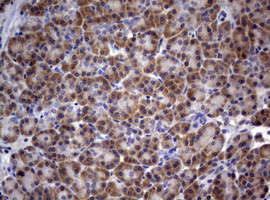 m03530 anti pi 3 kinase class 2a pik3c2a mouse monoclonal antibody clone id oti3h2 ihc testing 5
