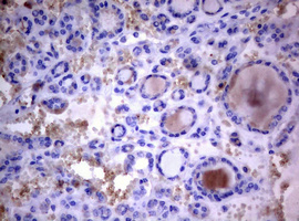 m03530 anti pi 3 kinase class 2a pik3c2a mouse monoclonal antibody clone id oti3h2 ihc testing 6