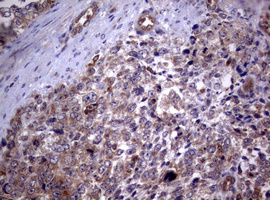 m03530 anti pi 3 kinase class 2a pik3c2a mouse monoclonal antibody clone id oti3h2 ihc testing 7