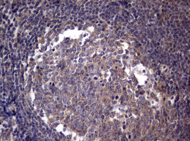 m03530 anti pi 3 kinase class 2a pik3c2a mouse monoclonal antibody clone id oti3h2 ihc testing 8