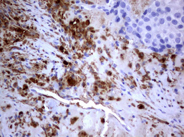 m03530 anti pi 3 kinase class 2a pik3c2a mouse monoclonal antibody clone id oti3h2 ihc testing 9