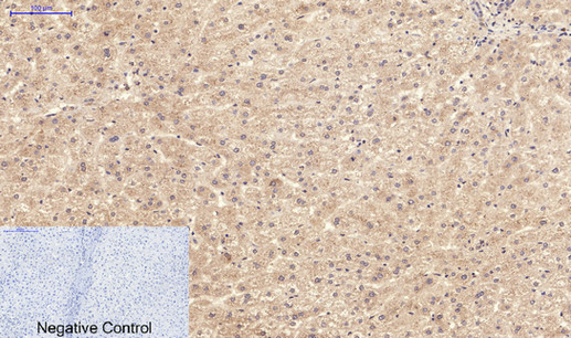 Immunohistochemical analysis of paraffin-embedded Human-liver tissue
