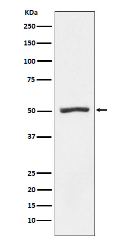 Western blot analysis of Proteasome 19S S5A expression in K562 cell lysate