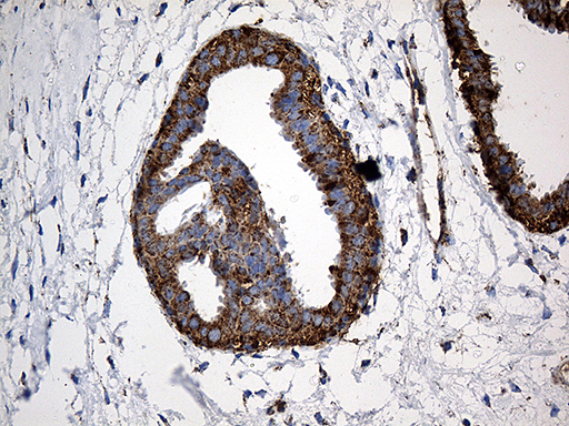 Immunohistochemical staining of paraffin-embedded Human breast tissue within the normal limits using anti-CYP7B1 mouse monoclonal antibody