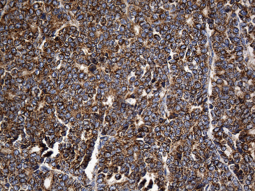 m03545 anti cyp7b1 mouse monoclonal antibody clone id oti1g7 ihc testing 4