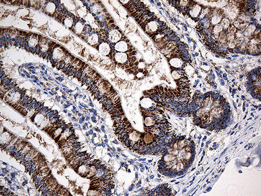 m03545 anti cyp7b1 mouse monoclonal antibody clone id oti1g7 ihc testing 5