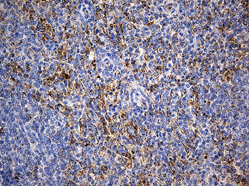 m03545 anti cyp7b1 mouse monoclonal antibody clone id oti1g7 ihc testing 6