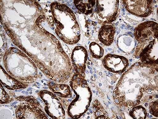 m03545 anti cyp7b1 mouse monoclonal antibody clone id oti1g7 ihc testing 7