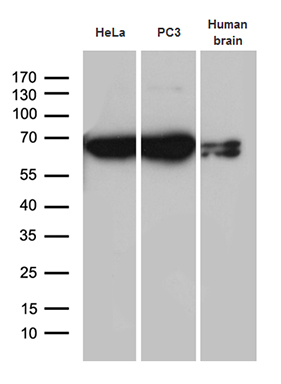Western blot analysis of extracts (35ug) from 2 cell lines and human brain tissue lysate by using anti-CYP7B1 monoclonal antibody (1:500)