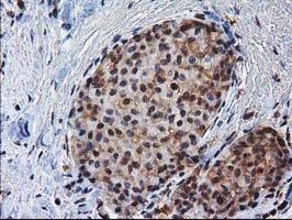 m03552 anti xlf nhej1 mouse monoclonal antibody clone id oti3d6 ihc testing 11