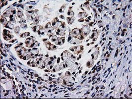 m03552 anti xlf nhej1 mouse monoclonal antibody clone id oti3d6 ihc testing 12