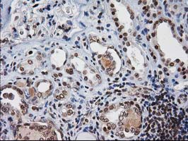 m03552 anti xlf nhej1 mouse monoclonal antibody clone id oti3d6 ihc testing 13