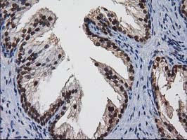 m03552 anti xlf nhej1 mouse monoclonal antibody clone id oti3d6 ihc testing 6