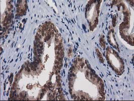 m03552 anti xlf nhej1 mouse monoclonal antibody clone id oti3d6 ihc testing 7