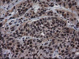 m03552 anti xlf nhej1 mouse monoclonal antibody clone id oti3d6 ihc testing 8