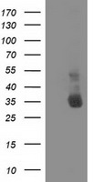 HEK293T cells were transfected with the pCMV6-ENTRY control (Left lane) or pCMV6-ENTRY NHEJ1 (Right lane) cDNA for 48 hrs and lysed
