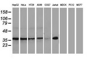 Western blot analysis of extracts (35ug) from 9 different cell lines by using anti-NHEJ1 monoclonal antibody