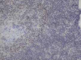 Immunohistochemical staining of paraffin-embedded Human lymph node tissue within the normal limits using anti-NEUROG3 mouse monoclonal antibody (Heat-induced epitope retrieval by 10mM citric buffer
