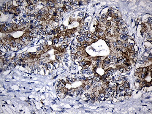 m03558 anti cpt1b mouse monoclonal antibody clone id oti2a6 ihc testing 10