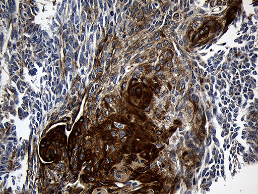 m03558 anti cpt1b mouse monoclonal antibody clone id oti2a6 ihc testing 4